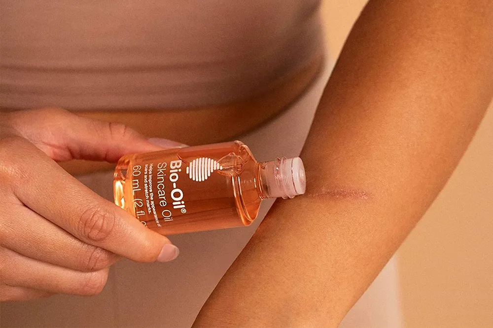 Dầu chăm sóc da Bio-Oil: Bí quyết hoàn hảo cho làn da không tì vết